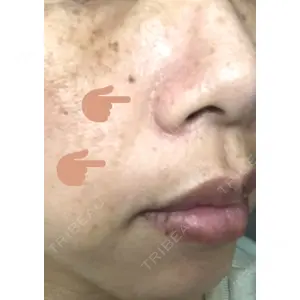 TCB東京中央美容外科 TCB東京中央美容外科 新宿三丁目院口コミ