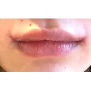 くさのたろうクリニック口コミ