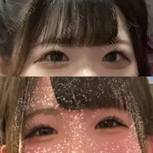 水の森美容クリニックの口コミ