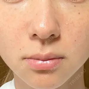 TCB東京中央美容外科 TCB東京中央美容外科 中野院口コミ