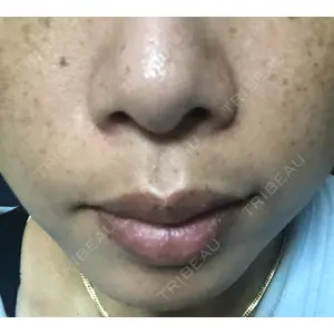 TCB東京中央美容外科 TCB東京中央美容外科 新宿三丁目院口コミ