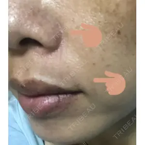 TCB東京中央美容外科 TCB東京中央美容外科 新宿三丁目院口コミ