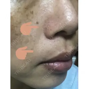 TCB東京中央美容外科 TCB東京中央美容外科 新宿三丁目院口コミ