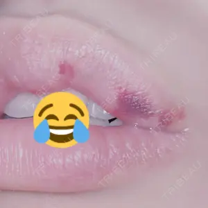 フィラークリニック フィラークリニック 町田院口コミ