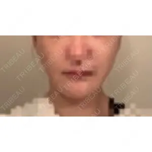 口コミ