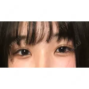 口コミ