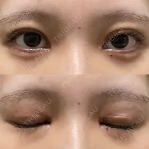 口コミ