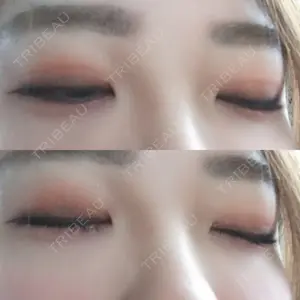 口コミ