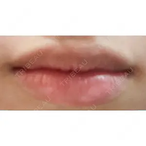 口コミ
