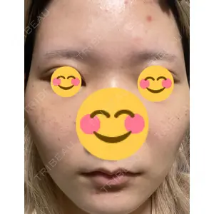東京銀座スキンケアクリニック口コミ