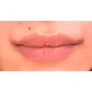 くさのたろうクリニック口コミ