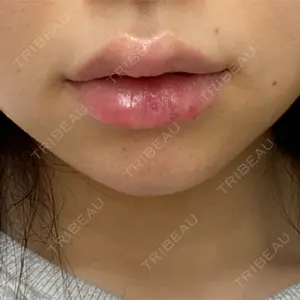 フィラークリニック フィラークリニック 町田院口コミ