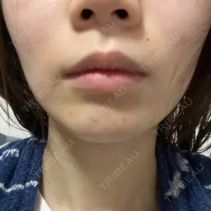 新宿美容外科クリニック 新宿美容外科クリニック 立川院口コミ