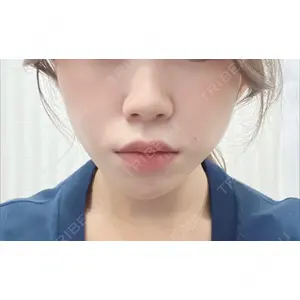 AI Beauty Clinic （エーアイ美容クリニック）口コミ