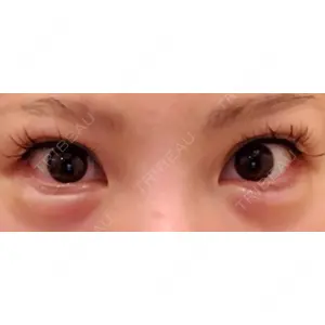 東京美容外科 梅田院の