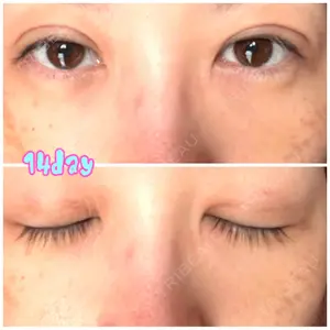 APOLLO BEAUTY CLINIC口コミ