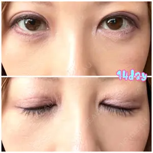 APOLLO BEAUTY CLINIC口コミ