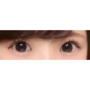 湘南美容クリニック 湘南美容クリニック 宇都宮院口コミ