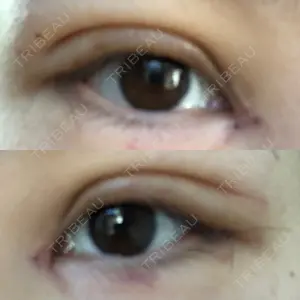 表参道スキンクリニック 表参道スキンクリニック 表参道院口コミ