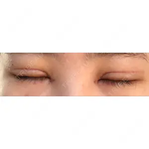 表参道スキンクリニック 表参道スキンクリニック 表参道院口コミ