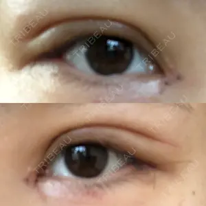 表参道スキンクリニック 表参道スキンクリニック 表参道院口コミ