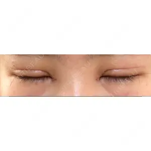 表参道スキンクリニック 表参道スキンクリニック 表参道院口コミ