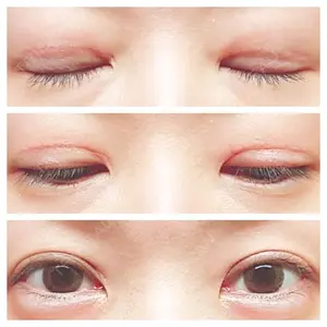 表参道スキンクリニック 表参道スキンクリニック 表参道院口コミ