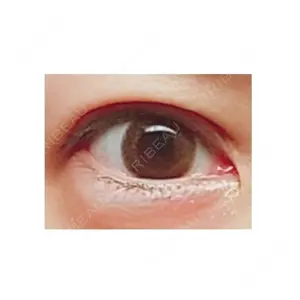 表参道スキンクリニック 表参道スキンクリニック 表参道院口コミ