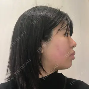 JBCジュノビューティークリニック 新宿三丁目院口コミ