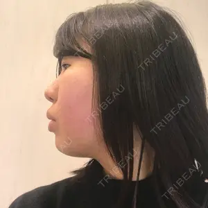 JBCジュノビューティークリニック 新宿三丁目院口コミ