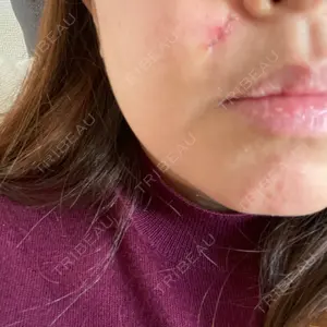 LIKI CLINIC KOBE口コミ