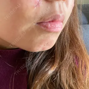 LIKI CLINIC KOBE口コミ