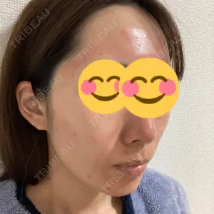 Rinato Beauty Clinic口コミ
