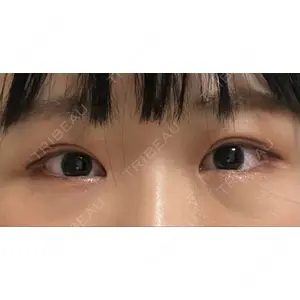 東京イセアクリニック口コミ