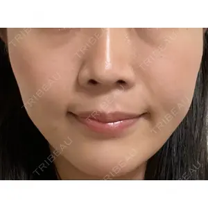 東京イセアクリニック口コミ
