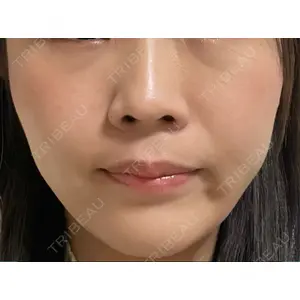 東京イセアクリニック口コミ
