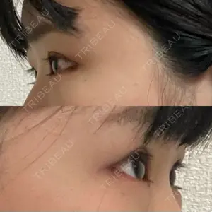 東京イセアクリニック口コミ