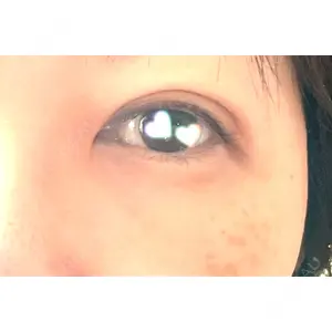 APOLLO BEAUTY CLINIC口コミ