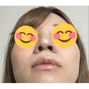 口コミ