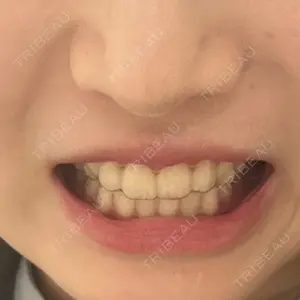 U DENTAL OFFICE 恵比寿口コミ