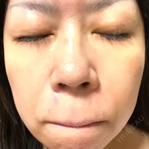 セオリークリニック口コミ