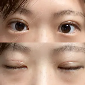 R.O.clinic口コミ