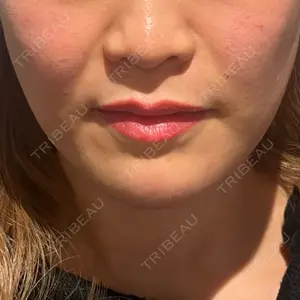 TCB東京中央美容外科 TCB東京中央美容外科 新宿東口院口コミ