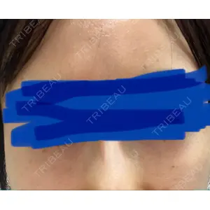 まゆりなclinic 名古屋栄口コミ
