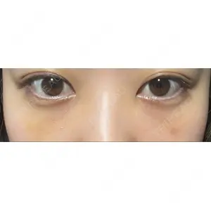 APOLLO BEAUTY CLINIC口コミ
