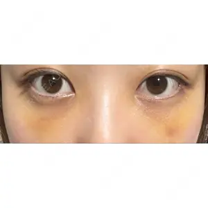 APOLLO BEAUTY CLINIC口コミ