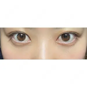 APOLLO BEAUTY CLINIC口コミ