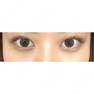 APOLLO BEAUTY CLINIC口コミ
