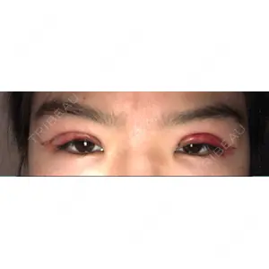 ブリスクリニック形成外科・美容外科・美容皮膚科 福岡口コミ