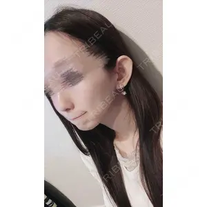 Kalon Clinic口コミ